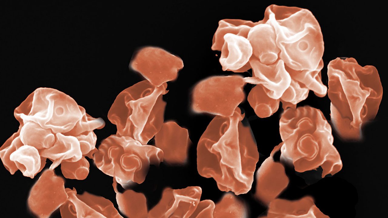 gut-performance-management