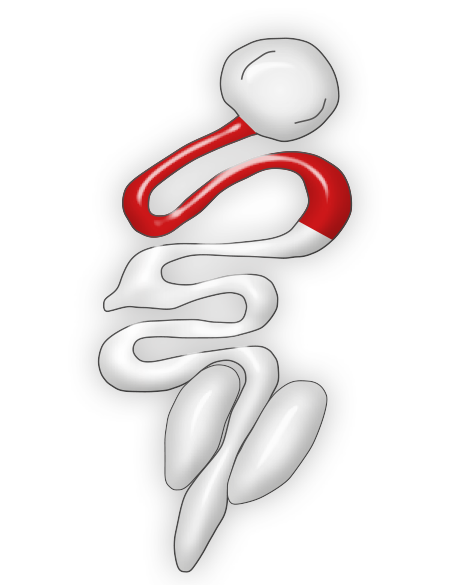 Eimeria preacox