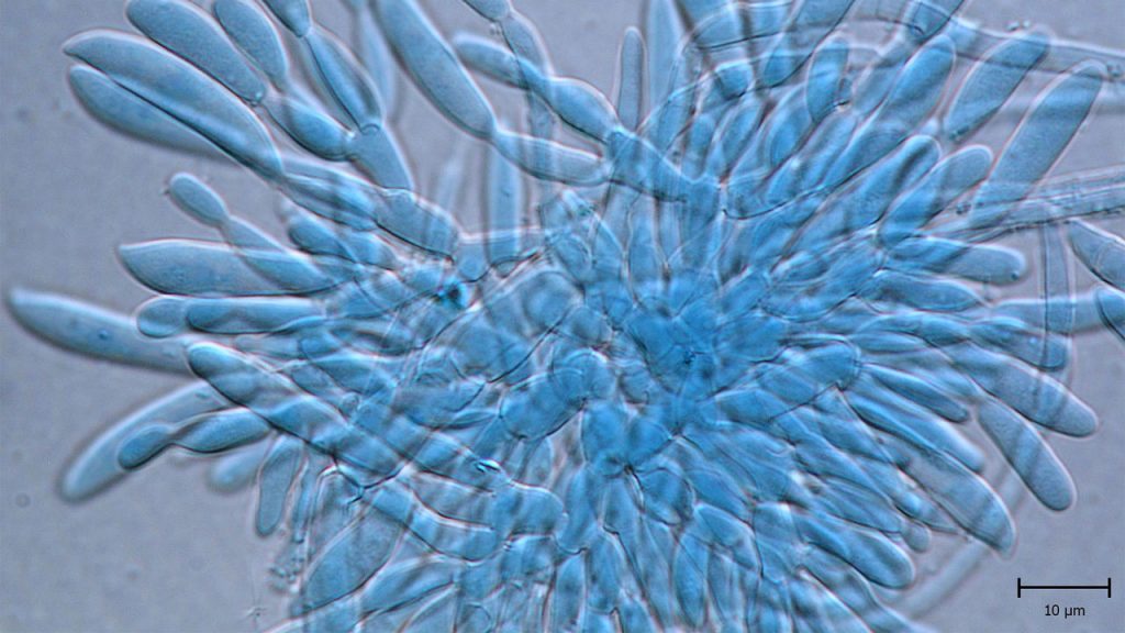 Fusarium Spores Identification And Pathogenicity Of Fusarium Spp.