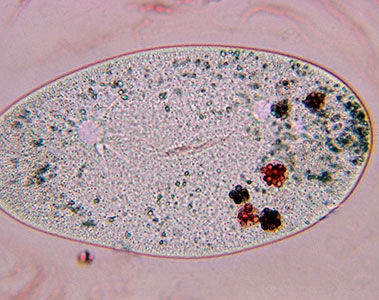 Net zero carbon protein: The cornerstone of a sustainable food system