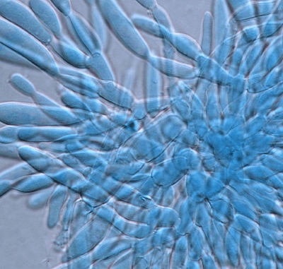 Detección de amenazas ocultas a la seguridad de los alimentos balanceados