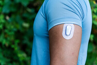 Athlete with Continuous Glucose Monitor Transmitter Adhered to Arm