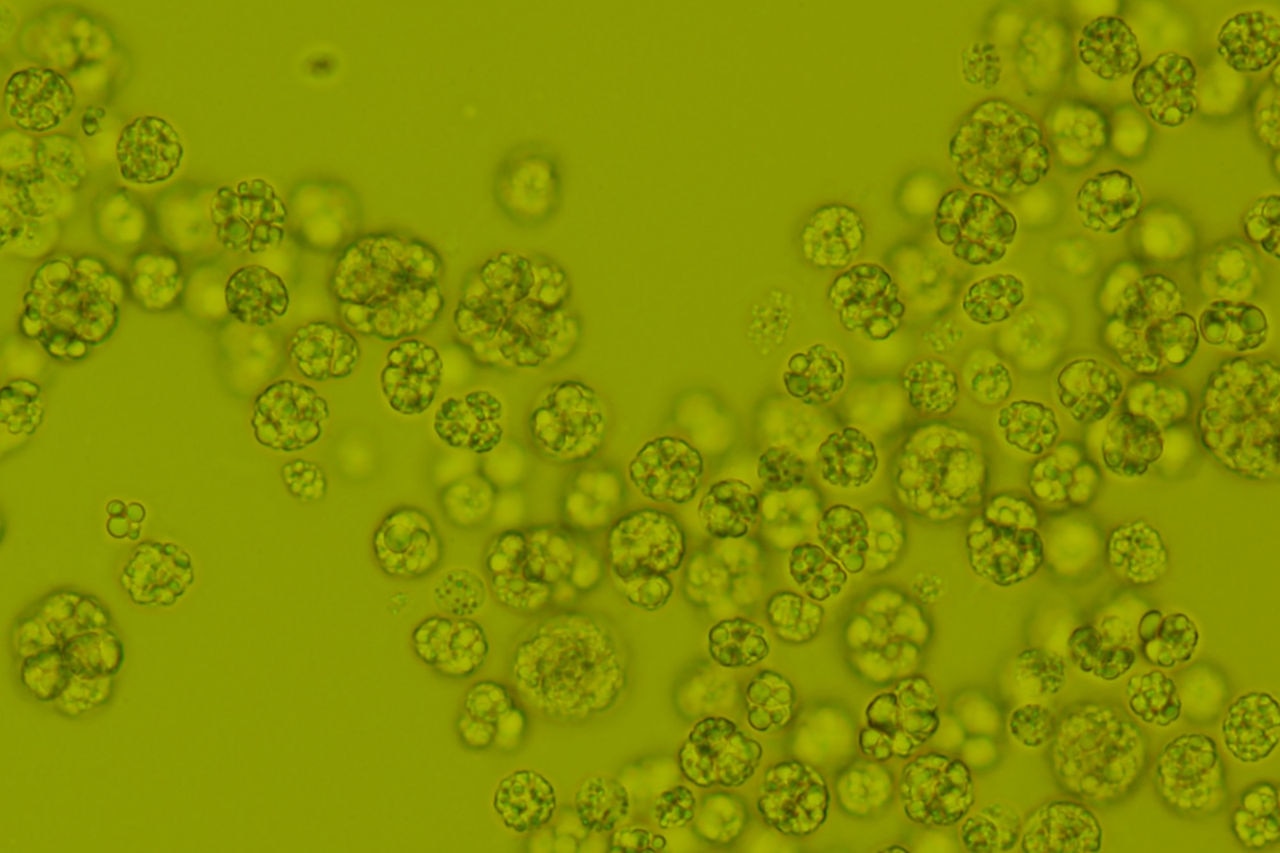 Green algae threw microscope view