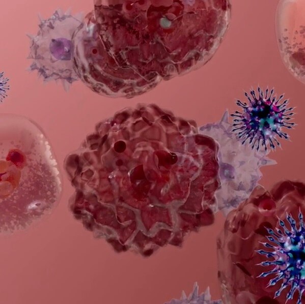 Chronic inflammation image