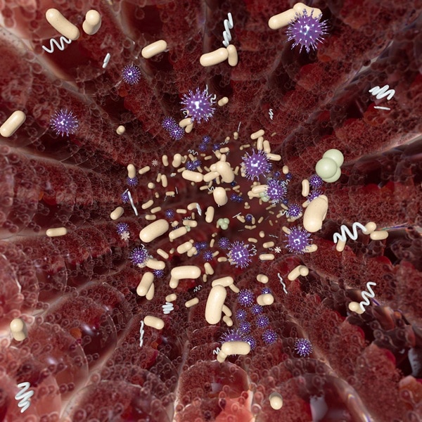 Chronic inflammation image