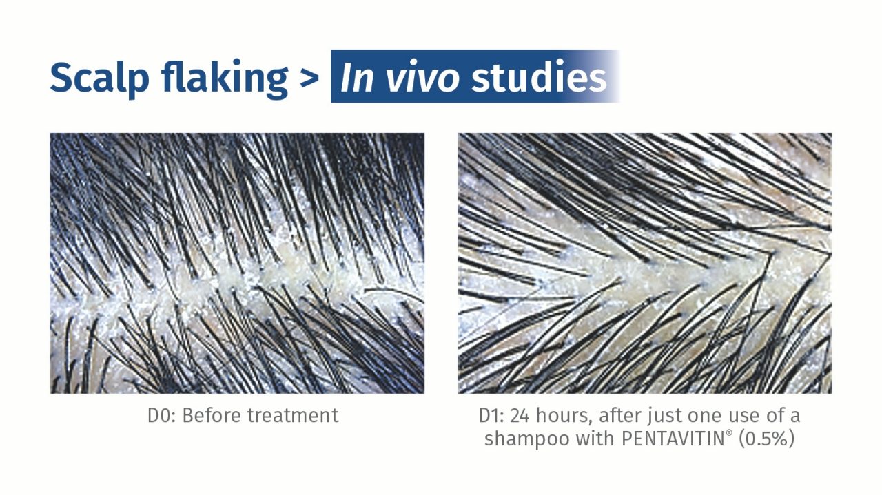 pentavin-hair-care-2.jpg