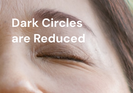 Dark circles are reduced