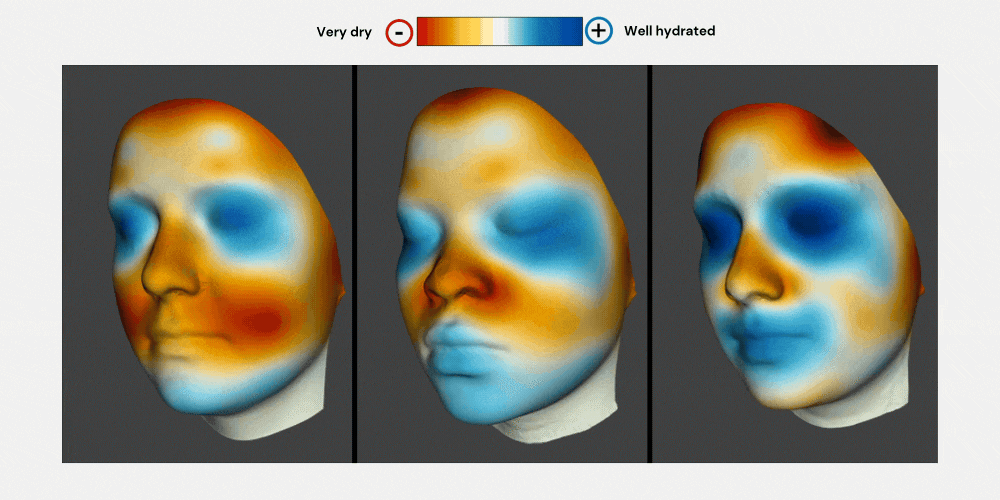 Skin mapping