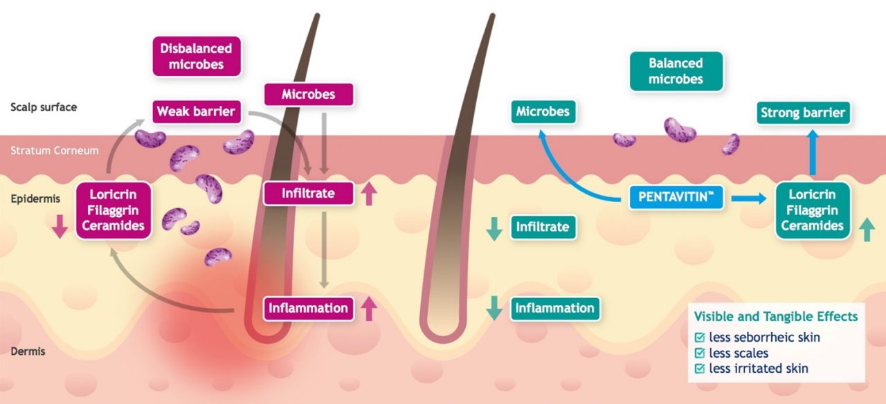 trend-skin-microbiome-cosmetic-ingredient.jpg