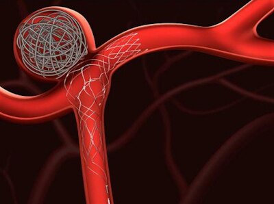 vascular_neurovascular.jpg