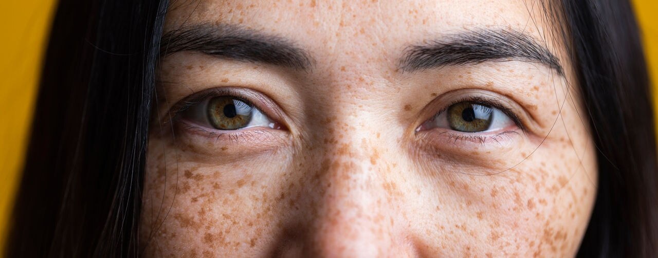 Close up on green eyes of beautiful Asian woman with freckles, looking at camera.